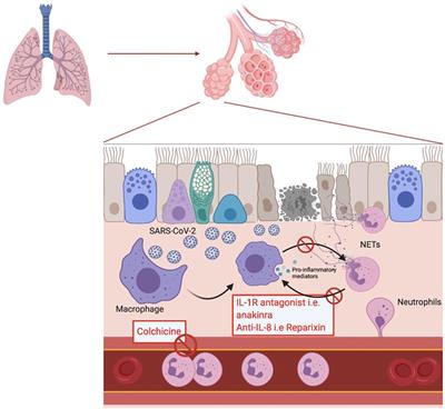 NETosis and the Immune System in COVID-19: Mechanisms and Potential Treatments